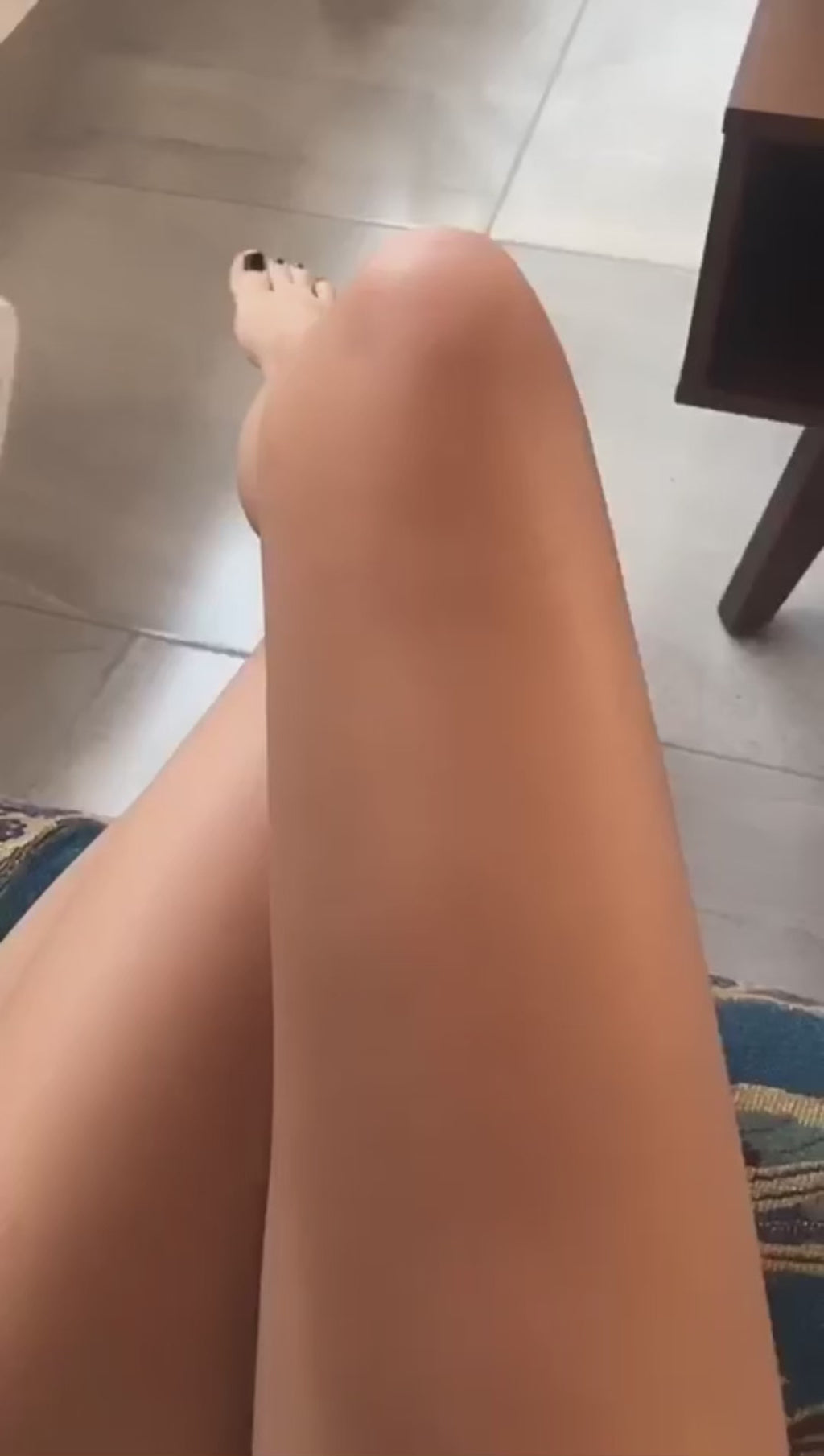 Depiladora Laser IPL